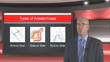 An image displaying some "Types of Anastomoses".
