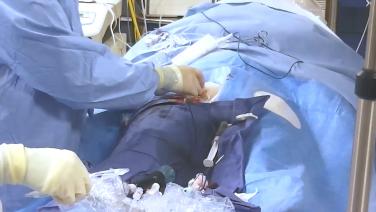 An image of the "Utilizing Intracardiac Echo During Transseptal Puncture with Brett Gidney, MD" video on the JnJInstitute.com website.