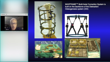 An image from the "Maximizing Post-Traumatic Deformity Planning with Spence Reid, MD" video on the JnJInstitue.com website.