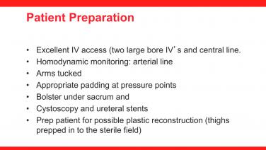An image of the "Management of Locally Recurrent Rectal Cancer with Jonathan Efron, MD" video.