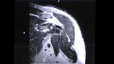 Surgeon's approach to Reading an MRI - Stephanie Muh, MD thumbnail