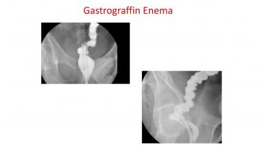 093798-180620Colorectal.jpg