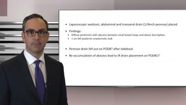 An image of the "Colorectal Case Study: 70 Year Old Man with T3N2 Rectal Cancer by Joe Carmichael, MD" video on the JnJInistitute.com website.