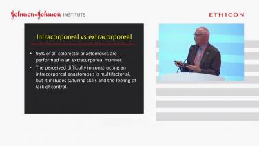 An image of the "Intracorporeal vs Extracorporeal: Inside or Outside?" video.