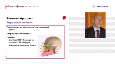 An image form the "Anterior versus Posterior Approach of C1-C2, An Overview with Prof M Winking" video on the JnJInstitute.com website.