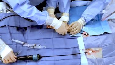 An image of the "Transseptal Puncture Techniques with Andrea Natale, MD" video.