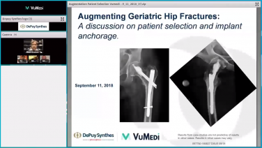 Augmenting Geriatric Hip Fractures - Patient Selection & Implant Anchorage