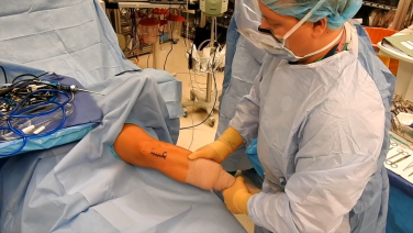 ACL Reconstruction Demo w/ Patella Tendon Autograft & MILAGRO Advanced Interference Screws