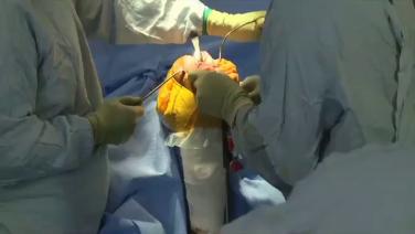 Image from the ATTUNE® Knee Surgical Insights, Rotating Platform video.