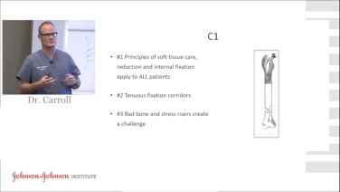 An image of the "Periprosthetic Femur Fractures: Vancouver C with Eben Carroll, MD" video.