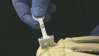 An image of the "SPEED Hand Procedure Video" video on the JnJInstitute.com website.