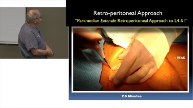 Anterior Approach to the Lumbosacral Spine with John Dimar, MD