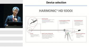 Right Hemicolectomy Using the HARMONIC® HD 1000I with Dr. Takashi Akiyoshi