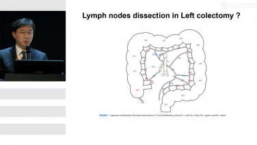 Inferior Mesenteric Vein Preserving in a Left Colectomy with Kang Young Lee, MD
