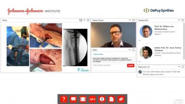 An image from the "Management of Fracture-Related Infections with Expert Tibial Nail PROtect" video on the JnJInstitute.com website.