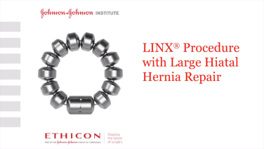 LINX Procedure Video – Large Hiatal Hernia with John Lipham, MD