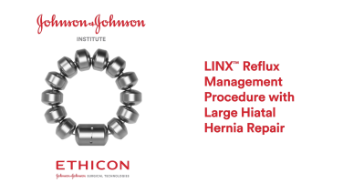 An Image From "Large Hiatal Hernia Repair Using LINX with John Lipham, MD"