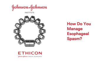 An Image From "Managing Esophageal Spasm with John Lipham, MD"