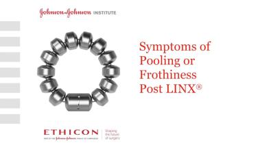 An Image From "Dr. Lipham - Symptoms of Pooling or Frothiness Post LINX"