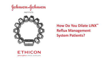 An Image From "LINX Reflux Management System Device Dilation with John Lipham, MD"