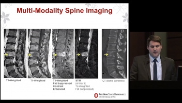 Imaging for Spinal Tumors with Daniel Boulter, MD