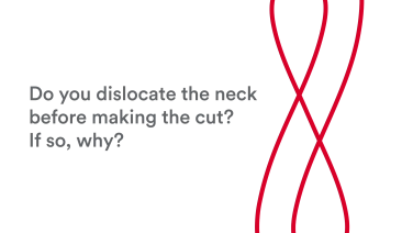 An image of the "ANTERIOR ADVANTAGE™ Discussion with Joel Matta, MD - Dislocate the Neck Before Making the Neck Cut & Why?" video on the JnJInstitute.com website.