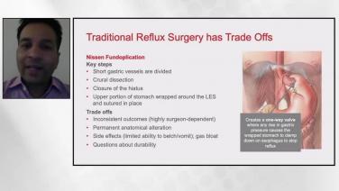 An Image from "Gastroesophageal Reflux Disease: Surgical Treatment - Gopal Grandhige, MD"