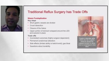 An Image from "Gastroesophageal Reflux Disease: Surgical Treatment - Gopal Grandhige, MD"