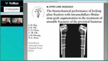 An image from the "Advances in Proximal Humerus Nailing - Rationale & Techniques Video" video on the JnJInstitute.com website.