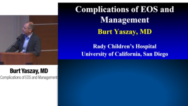 An image from the "Complications of Early Onset Scoliosis with Burt Yaszay, MD" video on the JnJInstitute.com website.