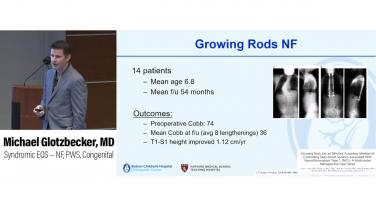 An image from the "Syndromic Early Onset Scoliosis with Michael Glotzbecker, MD" video on the JnJInstitute.com website.
