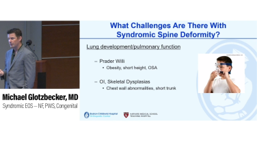 image of "Syndromic Early Onset Scoliosis with Michael Glotzbecker, MD" video on jnjinstitute.com