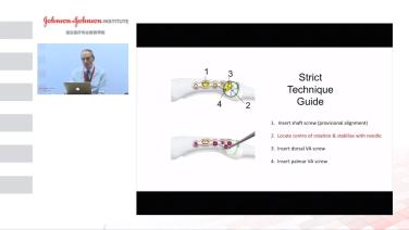 An image from the "The Phalangeal Neck Plate with Douglas Campbell, MD" video on the JnJInstitute.com website.