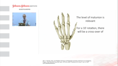 Rotational Malunions with Douglas Campbell, MD thumbnail image