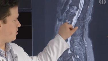 image for "BrainLab" Patient Indications" video found on JnJinstitute.com