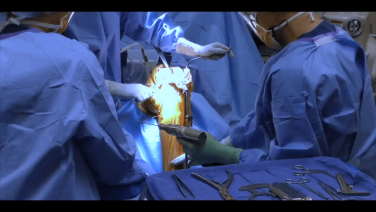 An image from the "Total Knee Arthroplasty: Exposure of the Proximal Tibia Using Alignment & Cutting Guides with William Barrett, MD & Jana Flener, PA-C" video on the JnJInstitute.com website.