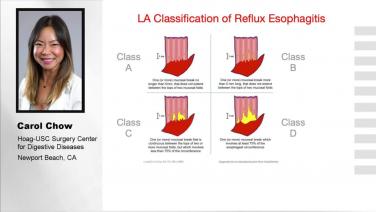 An Image from "Pre-Operative Management of LINX® Device Patients - Carol Chow, FNP-C, RNFA"