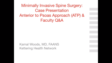 An image from the "Minimally Invasive Spine Surgery: Case Presentation Anterior to Psoas (ATP) and Faculty Q&A" video on the JnJInstitute.com website.