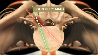Neuromonitoring Techniques with Jeffrey Roh, MD