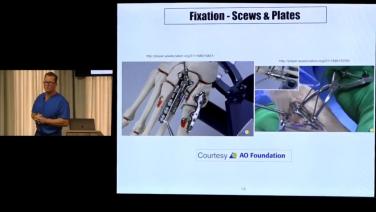 An image from the "Surgical Management for Midfoot Arthritis with Graham Hamilton, DPM, FACS" video on the JnJInstitute.com website.