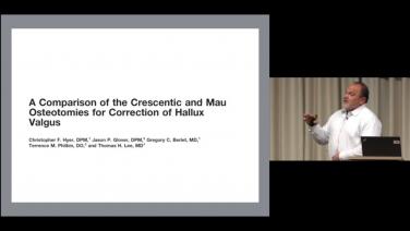 An image from the "Lapidus & Proximal Metatarsal Osteotomies: Literature Review with Brian G. Loder, DPM" video on the JnJInstitute.com website.