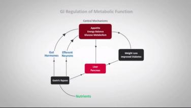 An image from the "How Surgery Changes the Set Point with David Kaplan, MD" video on the JnJInstitute.com website.
