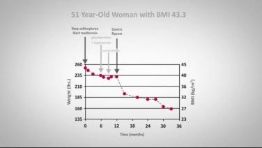 An image from "The Effects of Medication Post-Surgery with David Kaplan, MD"
