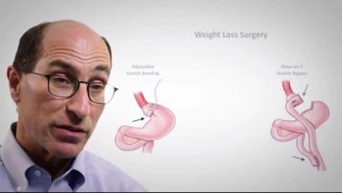 An image of the "Types of Surgery with David Kaplan, MD" video.
