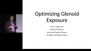 An image from the "Optimizing Glenoid Exposure with Paul Cagle, MD" video on the JnJInstitute.com website.