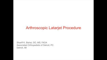 Arthroscopic Latarjet Procedure with Shariff Bishai, DO, MS, FAOAO