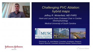 An image from the "CARTO®3 System V7 LAT Hybrid for PVC Mapping & Treatment with Gregory Winterfield, MD" video on the JnJInstitute.com website.