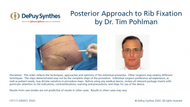 An image from the "Posterior Rib Fracture Approach with Tim Pohlman, MD" video on the JnJInstitute.com website.