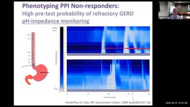 An image from the "GERD in the Era of Personalized Medicine: Results of the CALIBER Study with John Pandolfino, MD" video playlist on the JnJInstitute.com website.