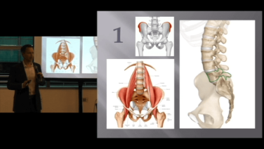 Improving the Anterior to Psoas Approach to the Lumbar Spine with Joshua Herzog, MD thumbnail